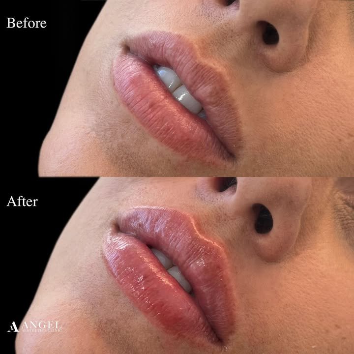 472204448_1499147350777337_5833806887604999292_n (1)