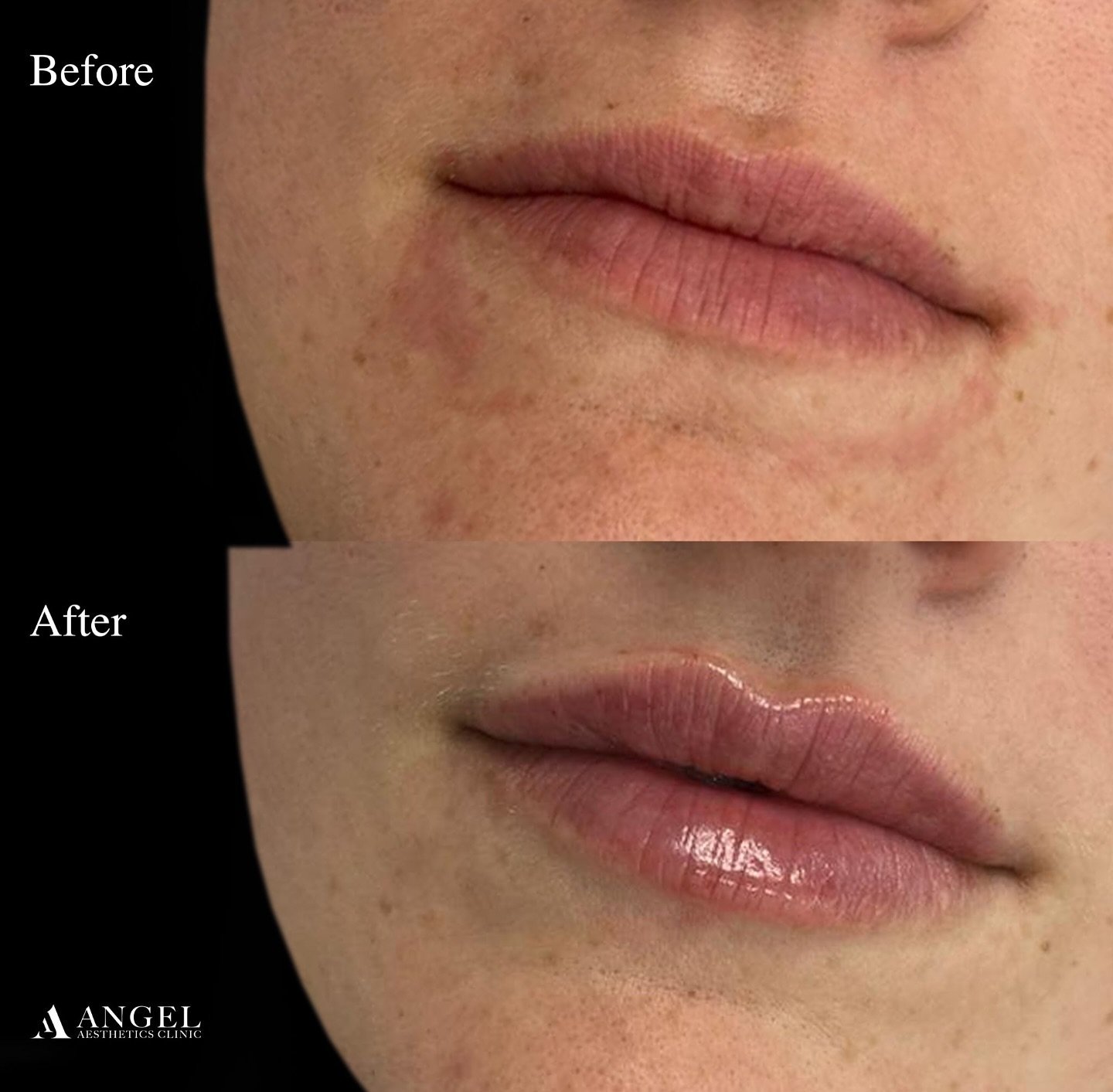 472914493_1618210909085064_4020260954913276701_n