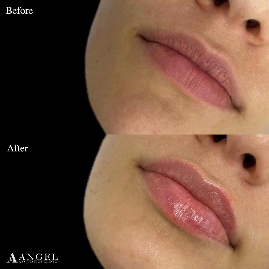 474654946_18291042847242169_8170299255406610174_n