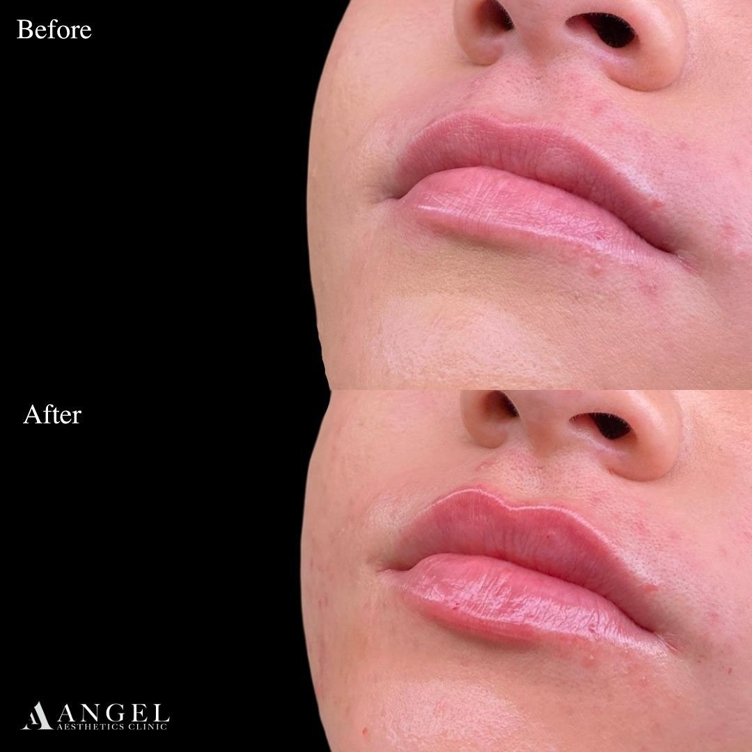 476274391_18292612489242169_7098899430624548358_n (1)