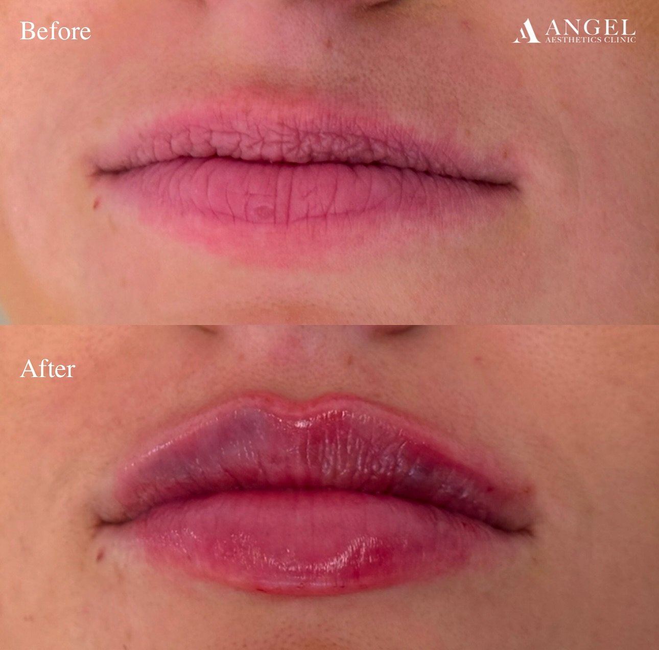 478406371_18293415010242169_3742277032802519286_n