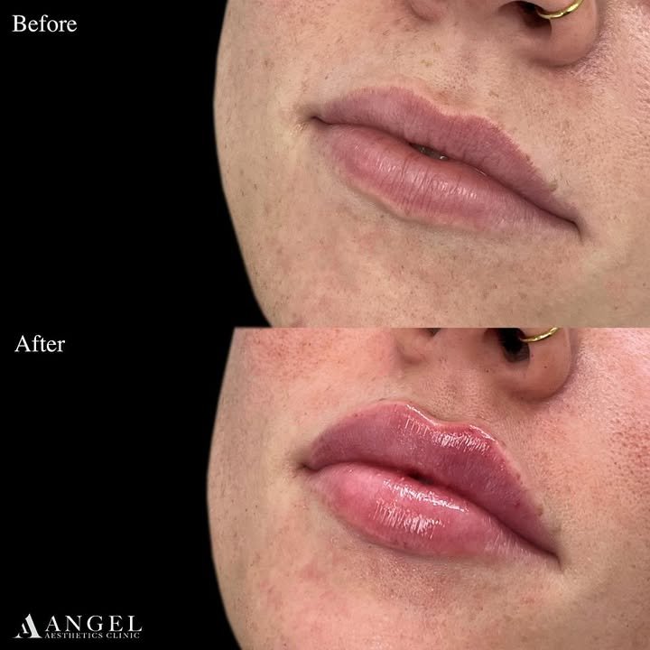 486585232_18298313398242169_1056477670796475090_n