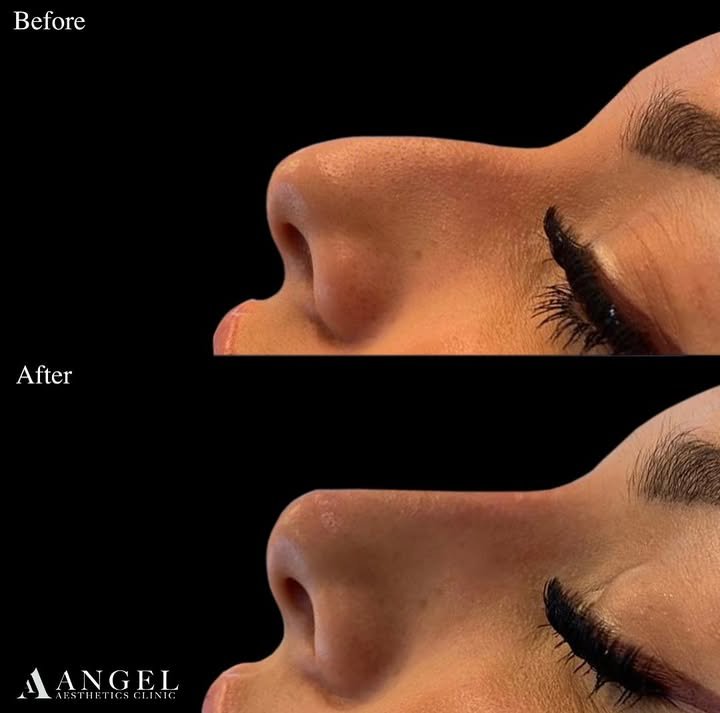 486745680_18298213846242169_4382779317727653700_n