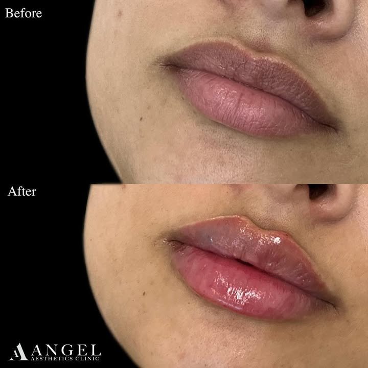 491422221_18301361968242169_109538607194655549_n