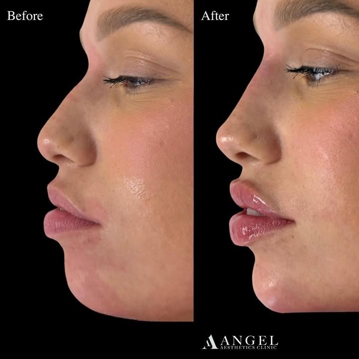 500204437_18304396363242169_1437924130961624061_n