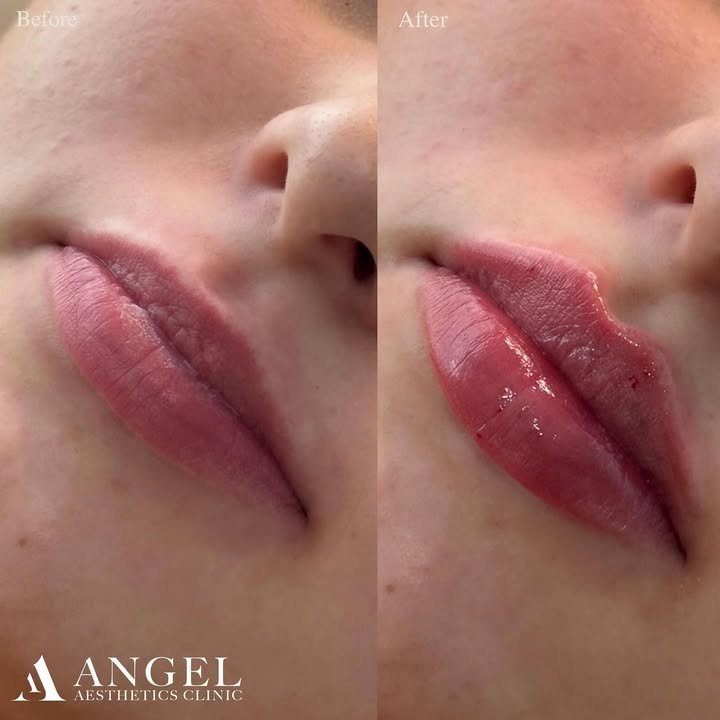 518224830_18310145170242169_6889437025548214544_n