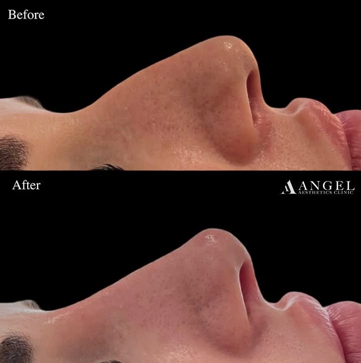 520480433_18310924759242169_4803091521932233059_n